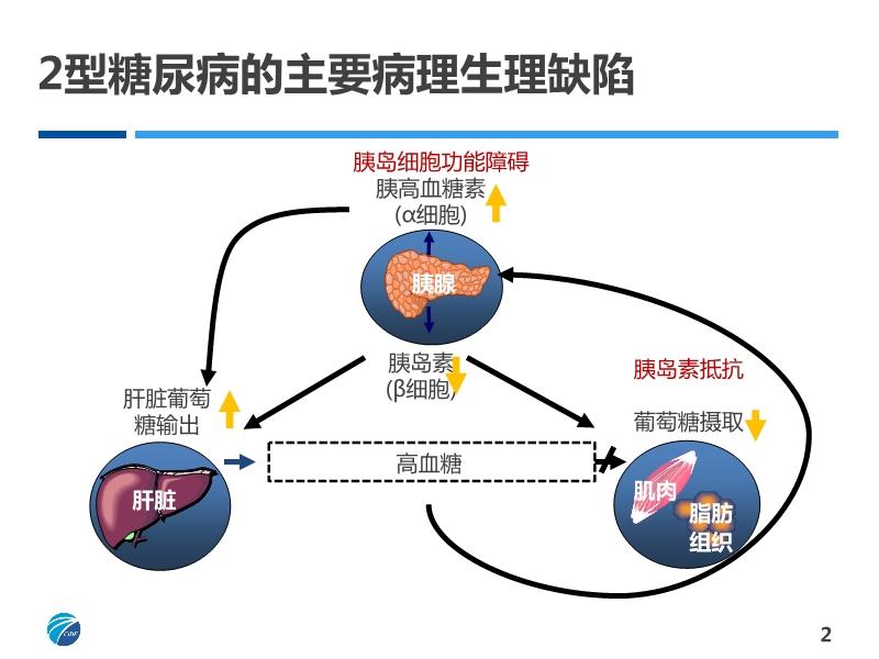 二型糖尿病最新疗法研究与应用进展